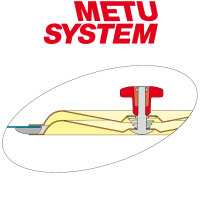METU Revisionsdeckel RD Alu mit SKK