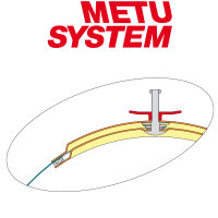 METU Revisionsdeckel RRD V2A HT
